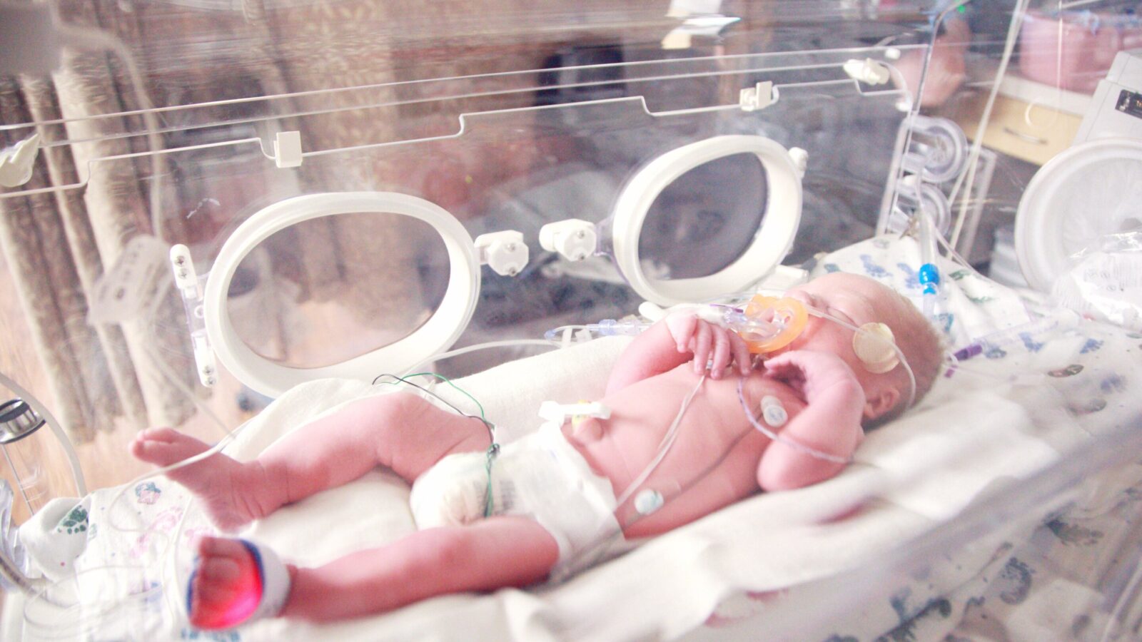 Nash Keen celebra su primer cumpleaños, un hito en la medicina neonatal. Foto: Centro de Salud de la Universidad de Iowa. Foto: Unplash