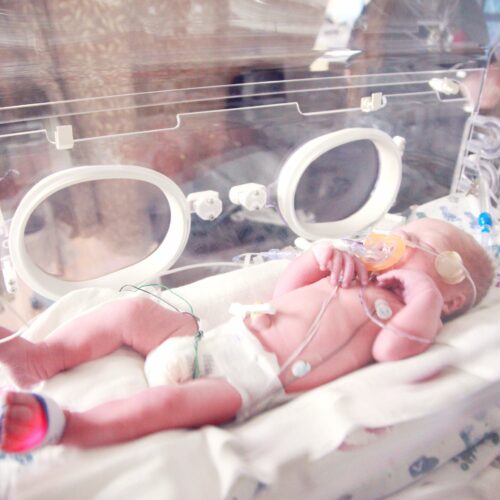 Nash Keen celebra su primer cumpleaños, un hito en la medicina neonatal. Foto: Centro de Salud de la Universidad de Iowa. Foto: Unplash