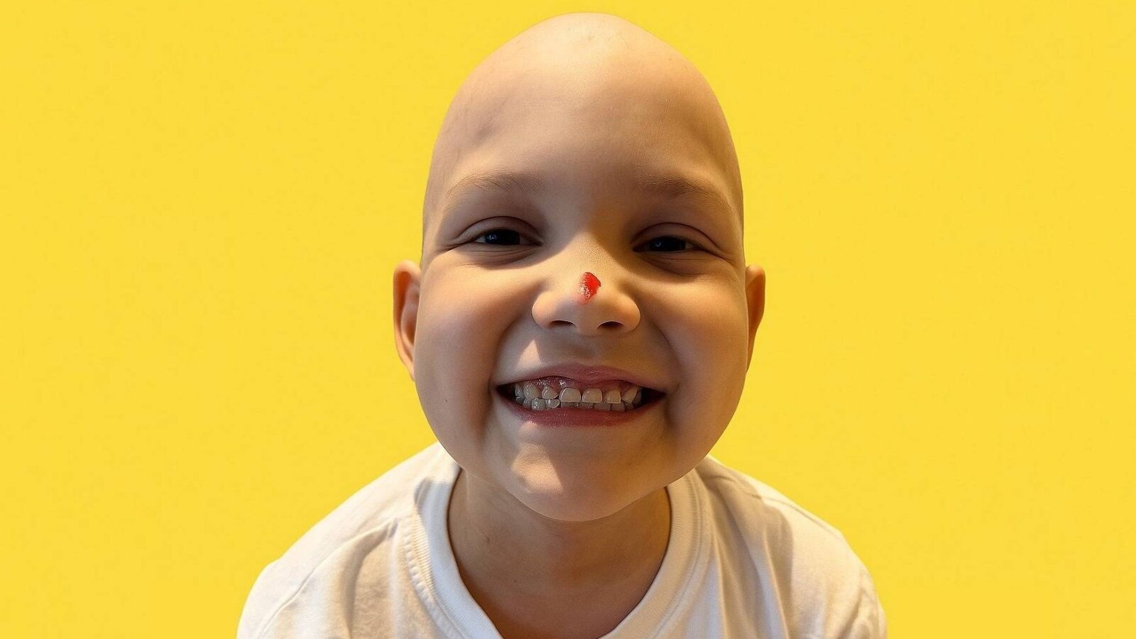 Santino, un niño de Misiones, superó una leucemia infantil de alto riesgo gracias a un tratamiento innovador y el apoyo de su comunidad. Foto: Instagram @amorporsantino.