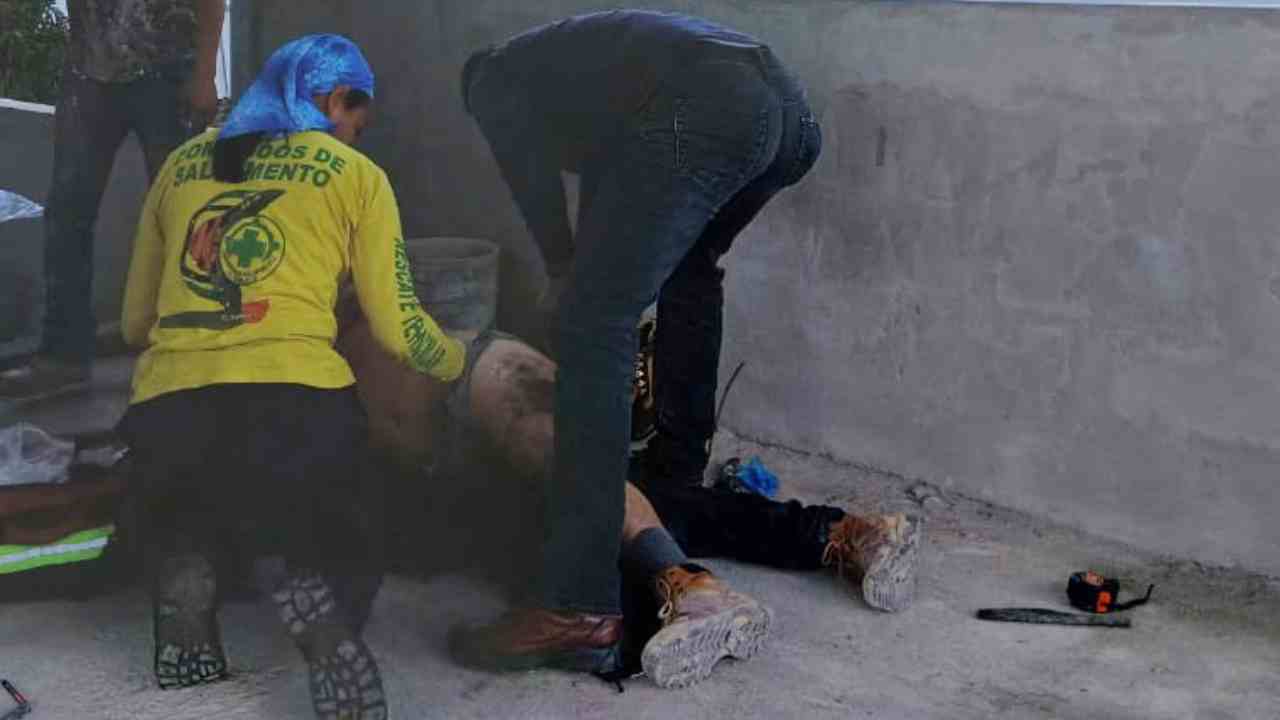 HERIDO. Las quemaduras, que incluyen ampollas y daño profundo, requieren atención médica. Autoridades informan del incidente. Cortesía.