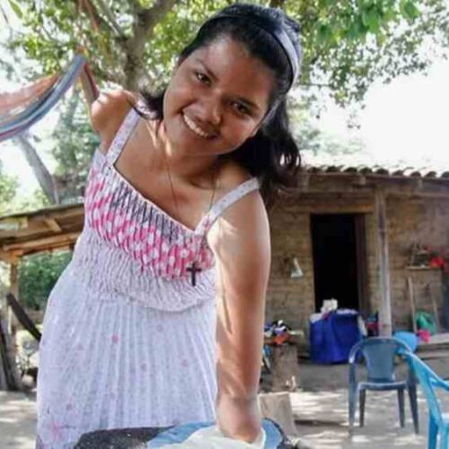 Carla Castellón, sobreviviente de un ataque con arma de fuego en 2015, comparte su historia para visibilizar el costo humano de la violencia en El Salvador. "No soy víctima, soy sobreviviente". Foto: Cortesía