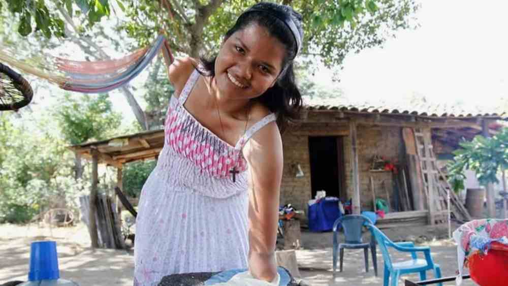 Carla Castellón, sobreviviente de un ataque con arma de fuego en 2015, comparte su historia para visibilizar el costo humano de la violencia en El Salvador. "No soy víctima, soy sobreviviente". Foto: Cortesía